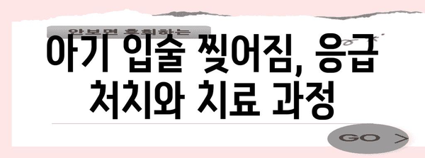 아기 입술 찢어짐 | 성모병원 응급실 후기