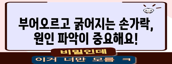 손가락 마디 통증 종료! 부음과 굵어짐 원인 및 치료법